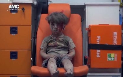Aleppo, la guerra sul volto di un bimbo salvato dai bombardamenti