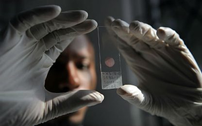 Oms, ogni due minuti un bimbo muore di malaria: mancano i fondi