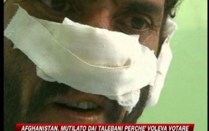 Afghanistan, "mutilato perché andavo a votare"